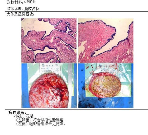 病理.jpg