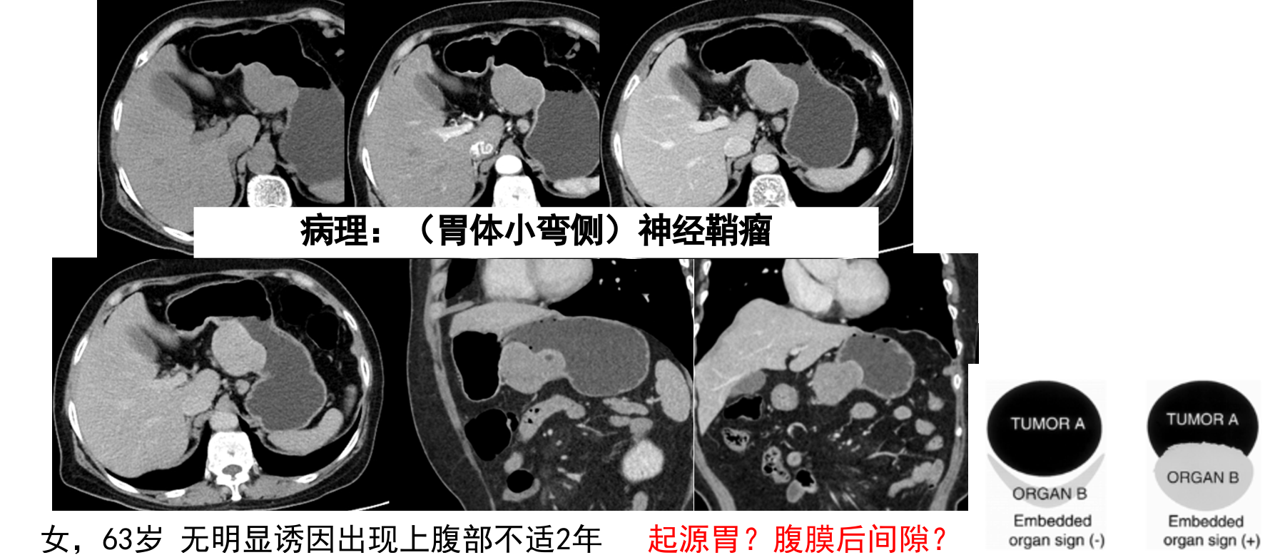 屏幕截图 2024-08-08 001923.png