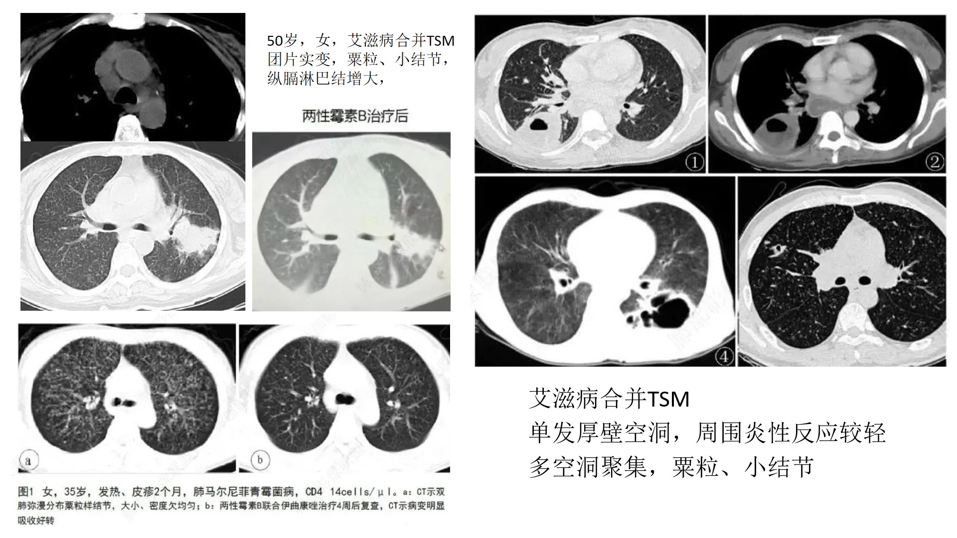 每例精解图片11.jpg