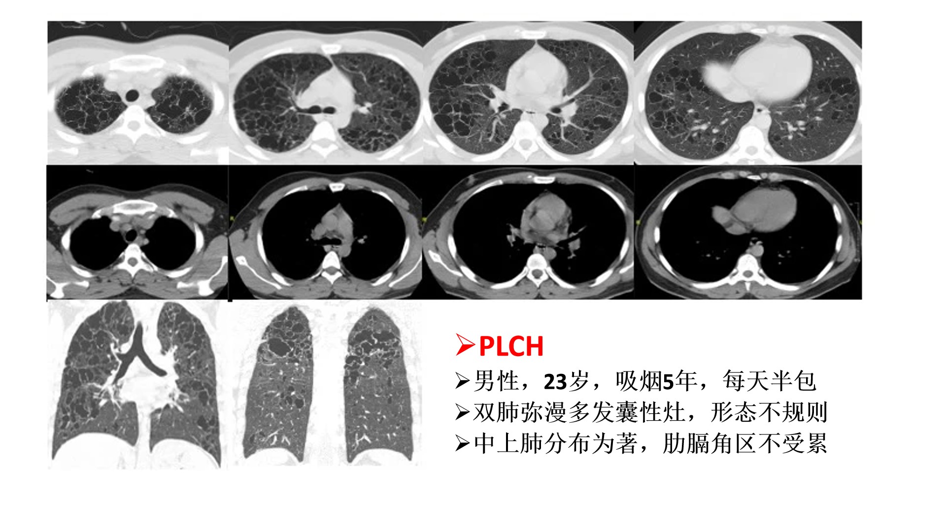 每例精解图片12.jpg