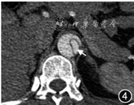 屏幕截图 2025-01-13 201548.png